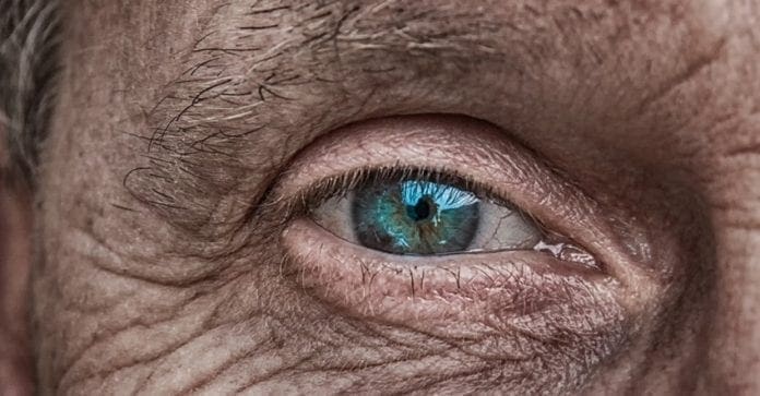 A photo of an eye of an older woman.
