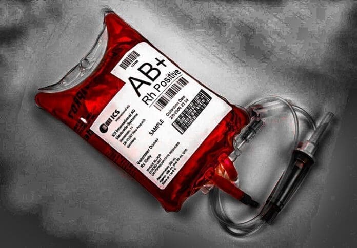 72ED623A-2D77-4BC0-8476-6482D63C3193 A unit of blood.